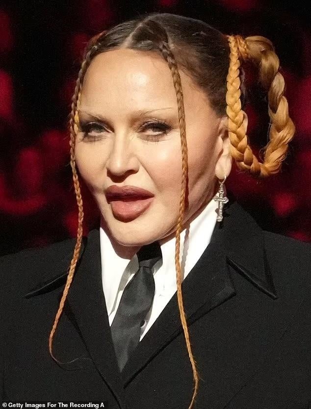 Nhan sắc nữ hoàng nhạc pop Madonna gây sốc, fan kêu gọi ngừng phẫu thuật thẩm mỹ - 2