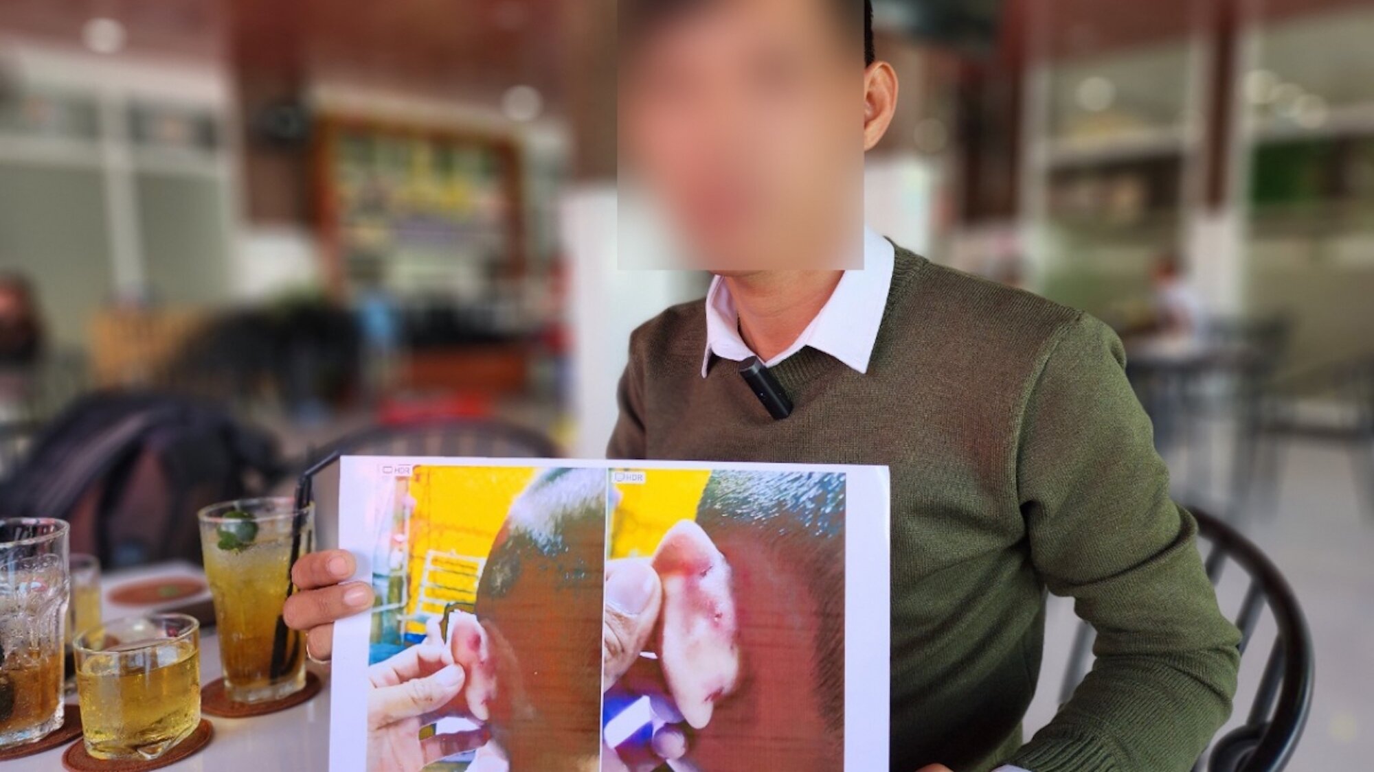 Khởi tố cô giáo mầm non đánh trẻ gây thương tích ở Kiên Giang - 1
